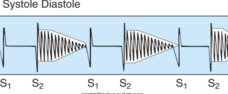 <ul><li><p><span style="background-color: transparent;">Between S<sub>2</sub> &amp; S<sub>1</sub></span></p></li></ul><p><br></p>