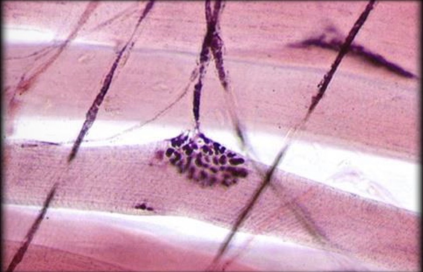 <p>when neuron meets muscle fibers </p>