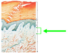 <p>DERMAL LAYER</p><p>LOCATION:</p><p>superficial dermal layer</p><p>*rete ridges*</p><p>COMPOSITION</p><p>cellular:</p><p>- ECM</p><p>- loose collagen</p><p>- elastin</p><p>extracellular:</p><p>- lymphatic capillaries</p><p>- blood capillaries</p><p>- Meissner's corpuscles</p><p>(movement)</p>