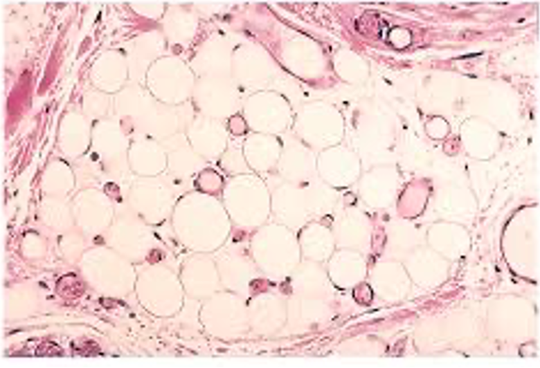 <p>fat, cushion for sensory organs</p>