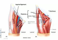 <p>Triangular space in the super anterior third of the thigh.</p><p>1) Found at the junction between the trunk and lower limb.</p><p>*Femoral artery can be palpated here*</p>