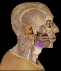 <p>Identify the structure</p>