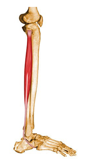 <p>What muscle is this? <br>Name, Origin, Insertion, Action, Exercise</p>