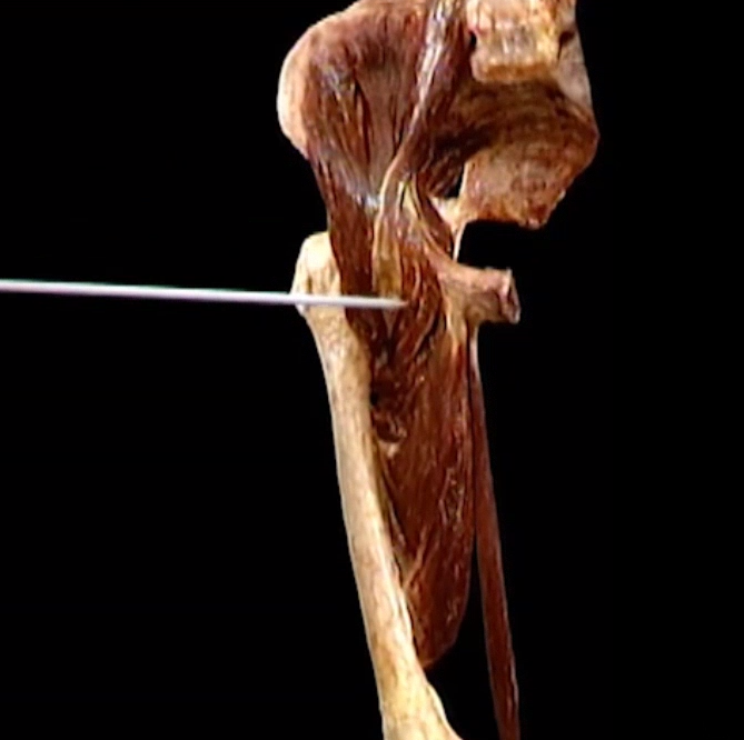 <p>Diep, anterior zicht</p>