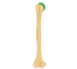 <p>What bone landmark is this within the <strong>Humerus </strong></p>