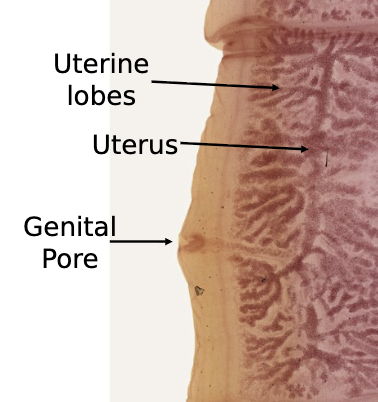 <p>gravid proglottid</p>