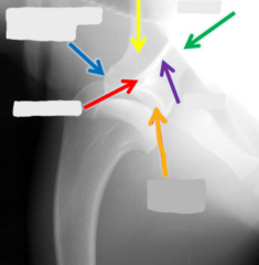 <p>What is the orange arrow pointing to?</p>