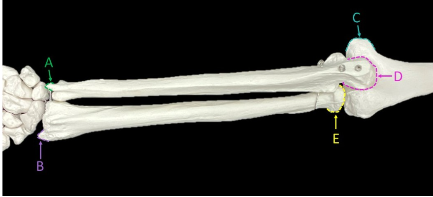 <p>Does the image show an anterior or posterior view? </p><p>Label A-E. </p>