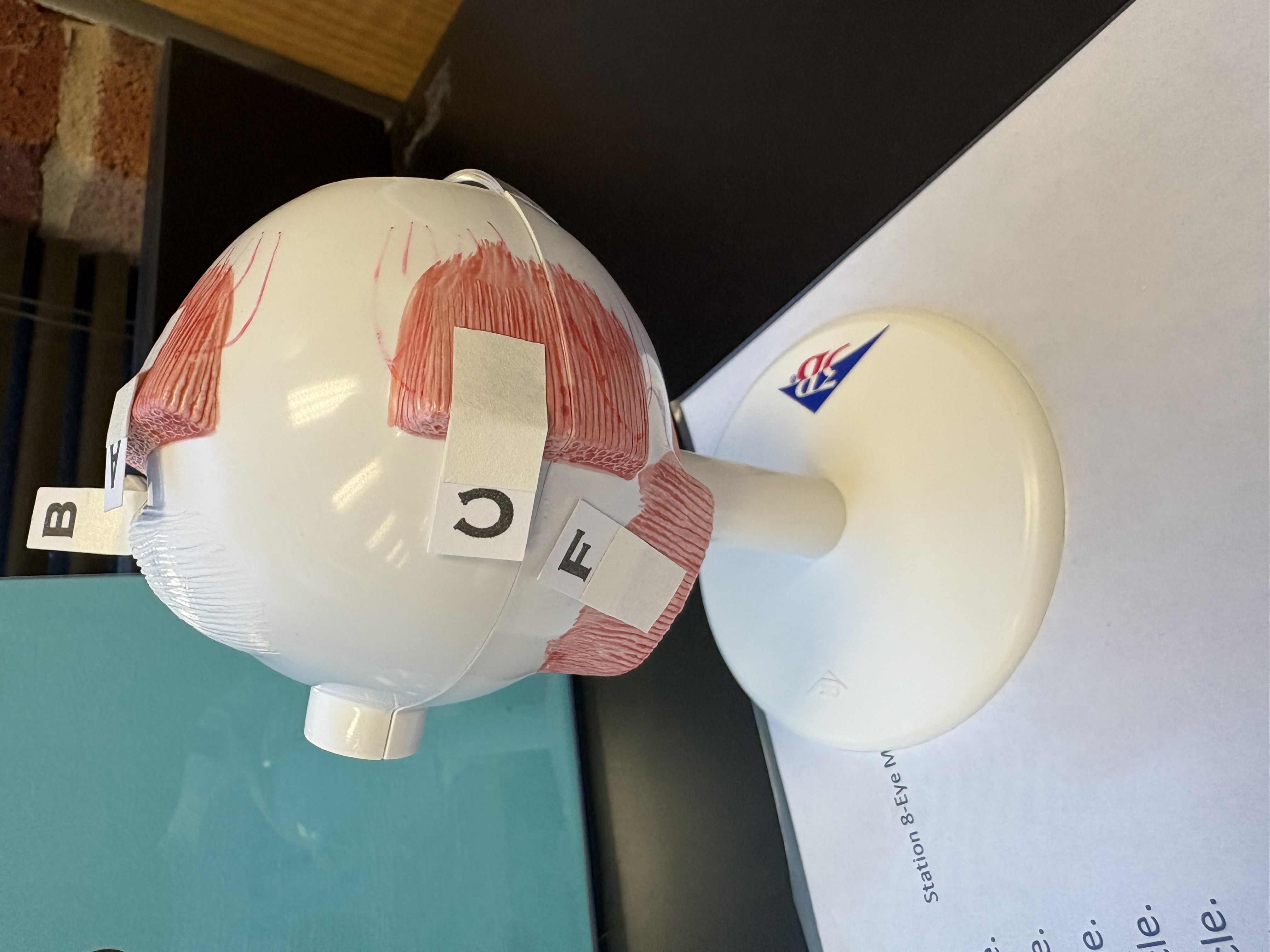 <p>F. identify this muscle</p>