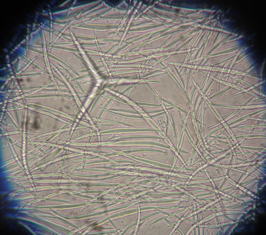 <p><span>The following picture is a microscopic view of</span></p>