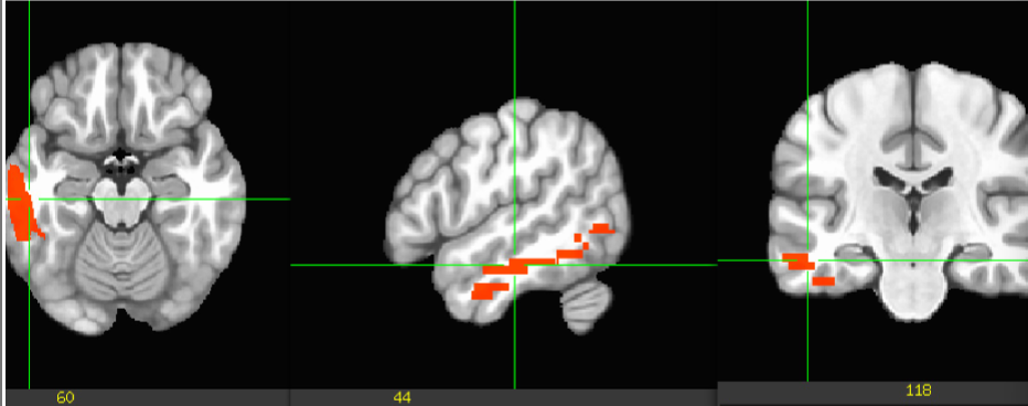 term image