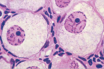<p>Are the nucleoli active or inactive?</p>