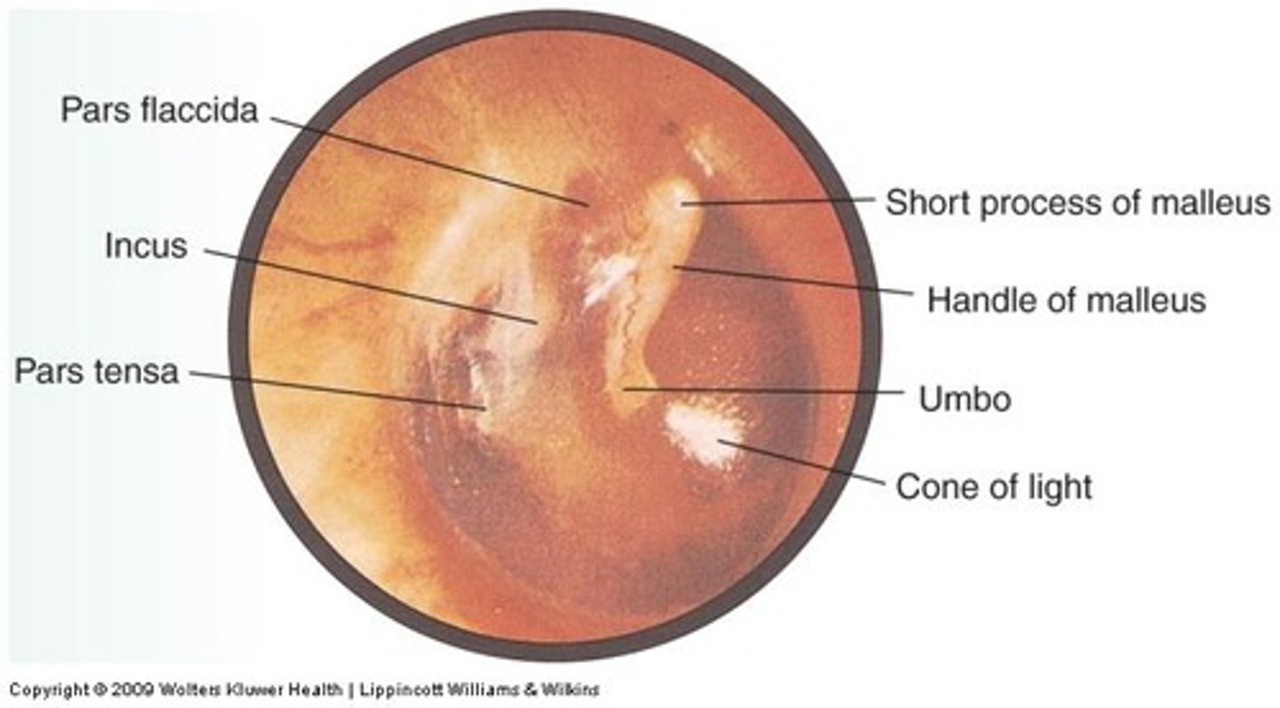 <p>knob of the malleus that shows through the tympanic membrane</p>