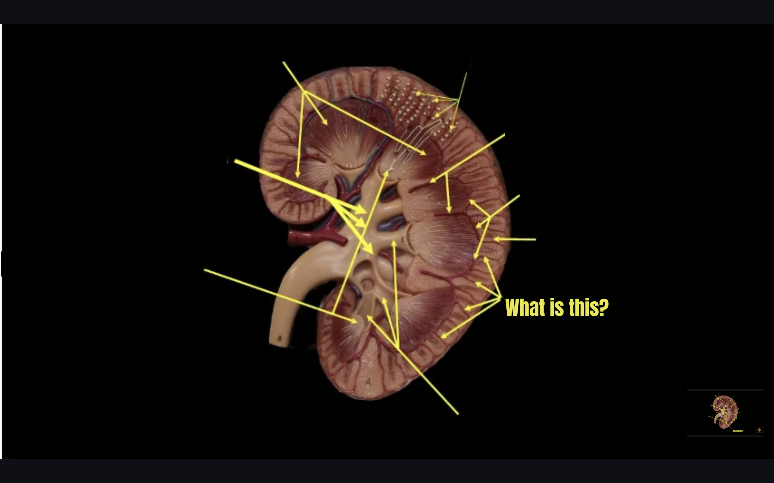 term image
