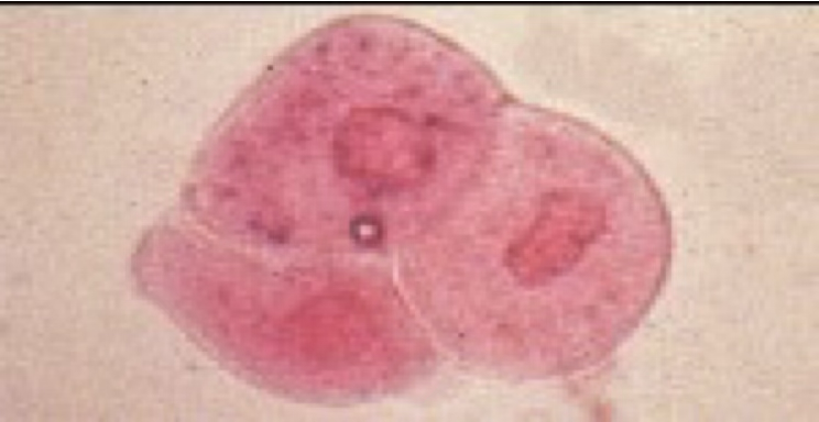 <ul><li><p>Usually round, but may appear pear-shaped or caudate (have a tail)</p></li><li><p>A low number may be seen due to sloughing of old cells.</p></li><li><p>An increased number seen can indicate cystitis or pyelonephritis</p></li></ul><p></p>