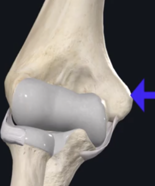 <p>what is the name of this following boney outgrowth on the distal end of the humerus?</p>