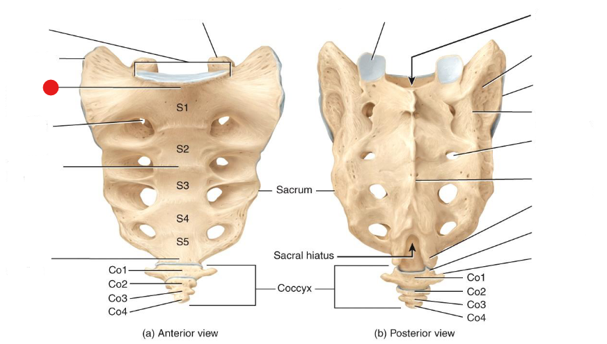 <p>Identify the structure pinned </p>