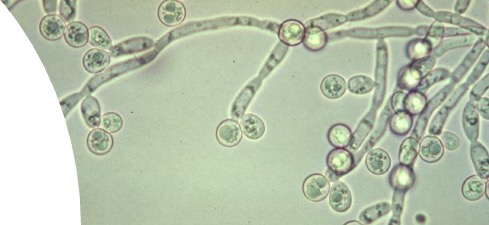 <p><span>Chains of elongated yeast cells that remain attached after budding, forming filaments with distinct constrictions</span></p>