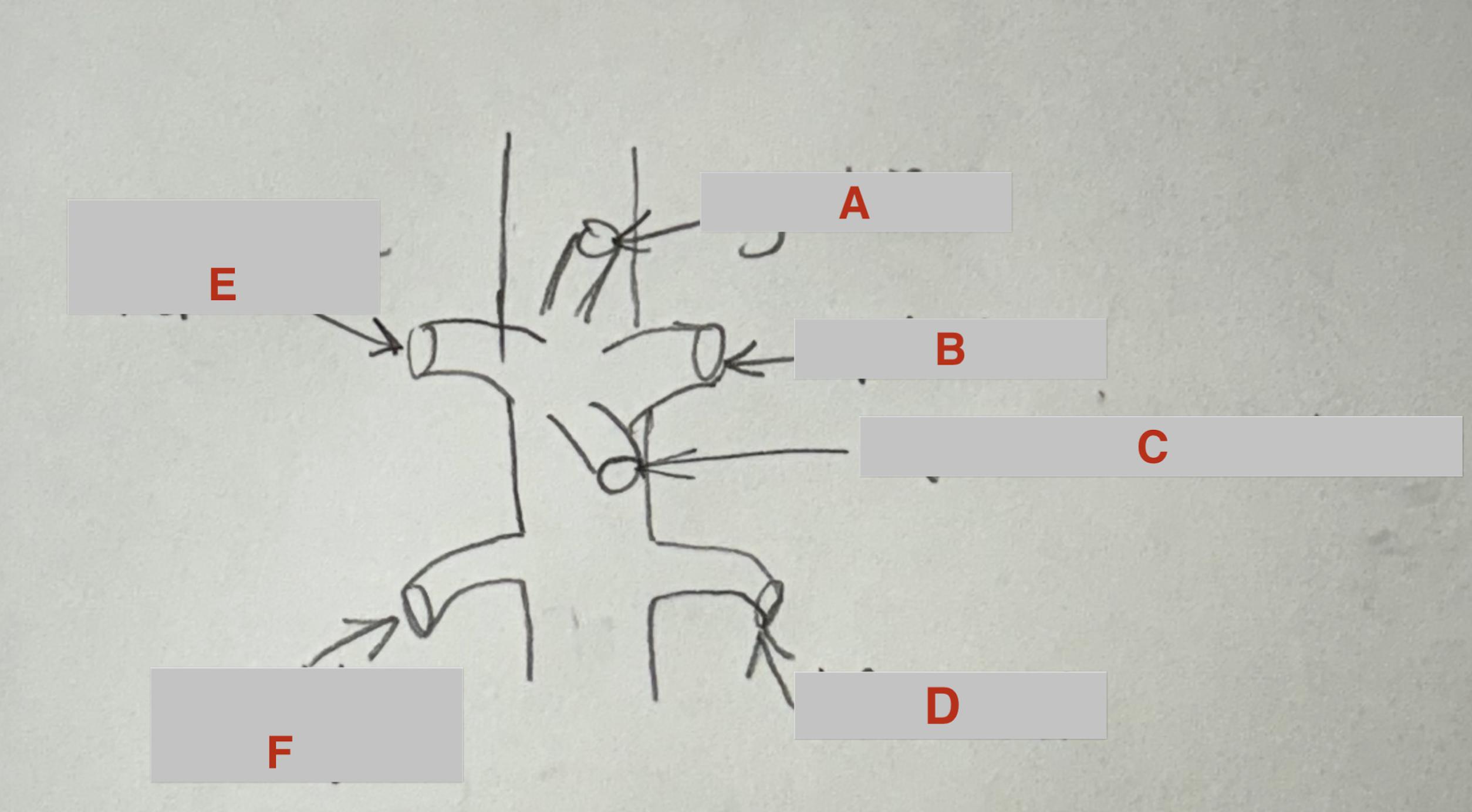 <p>What vessel is B?</p>