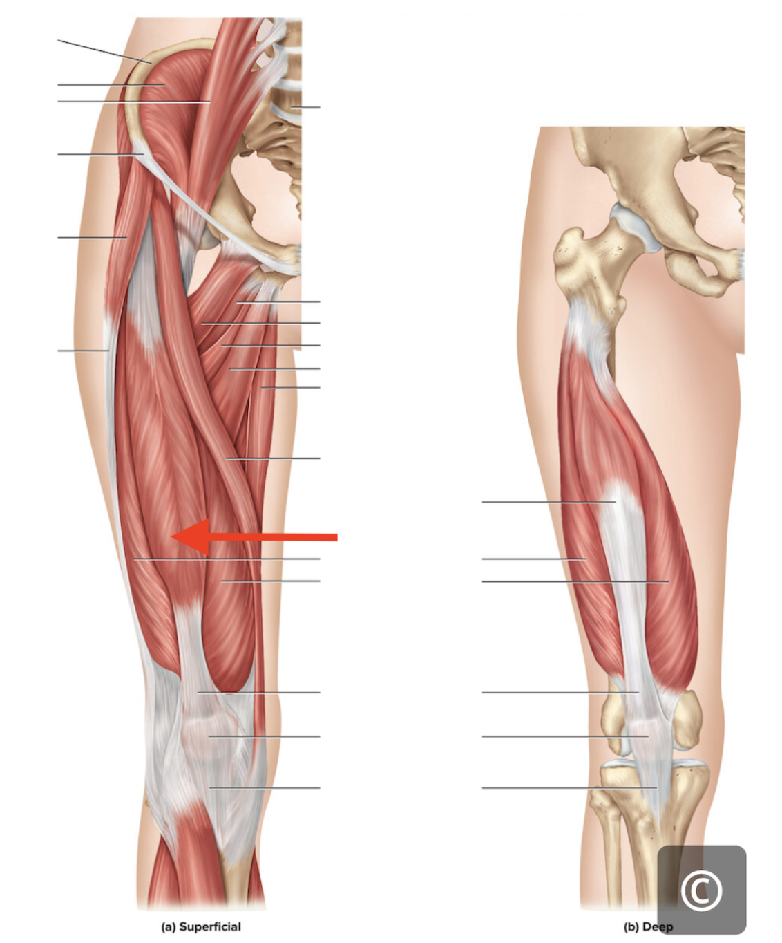 <p>Rectus femoris</p>