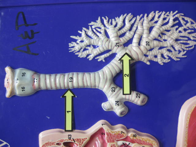 <p>Identify 1, and 2?</p><p>Lab Image 5-2</p>