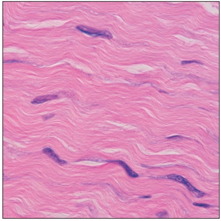 <p><span>Connective Tissue Proper: dense connective tissue, dense regular</span></p>