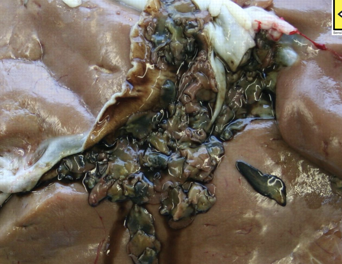 <p>What parasite causes this?</p>