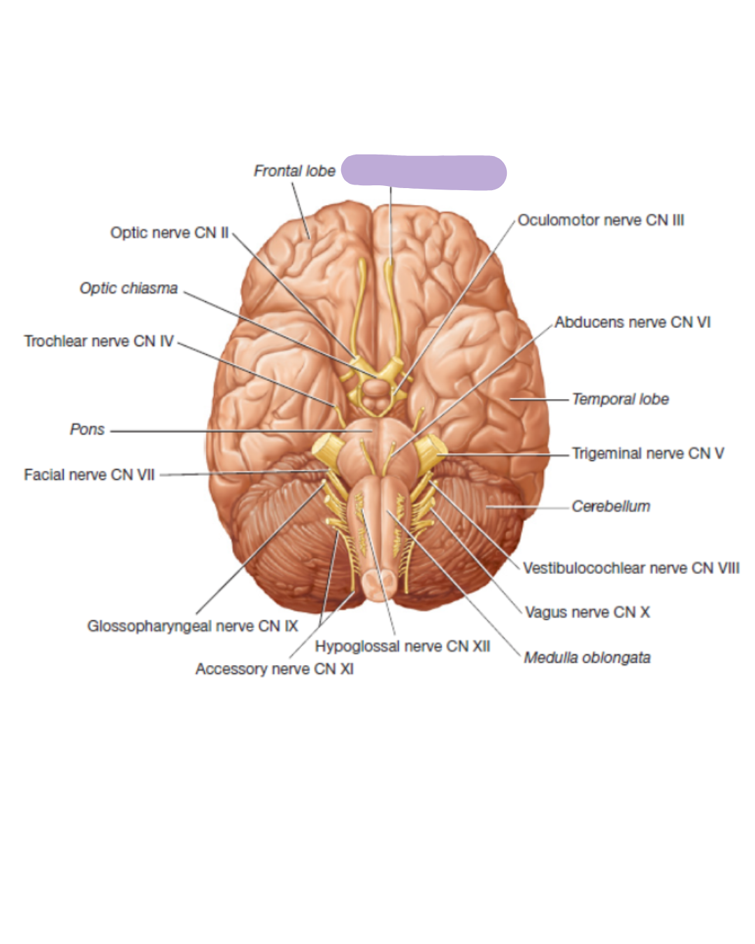 <p>Find the CN I Olfactory Nerve</p>