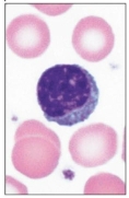 <p>lymphocytes</p>