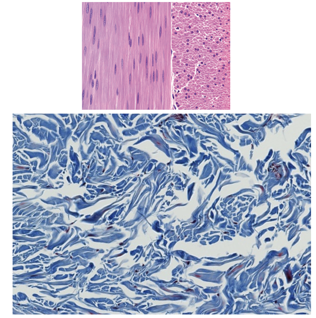 <p><span style="font-family: "Calibri Light";">1. Which basic type of CT is this?<br><br>2. Can you be more specific?</span></p>