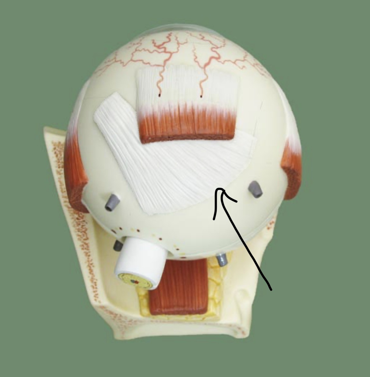 term image