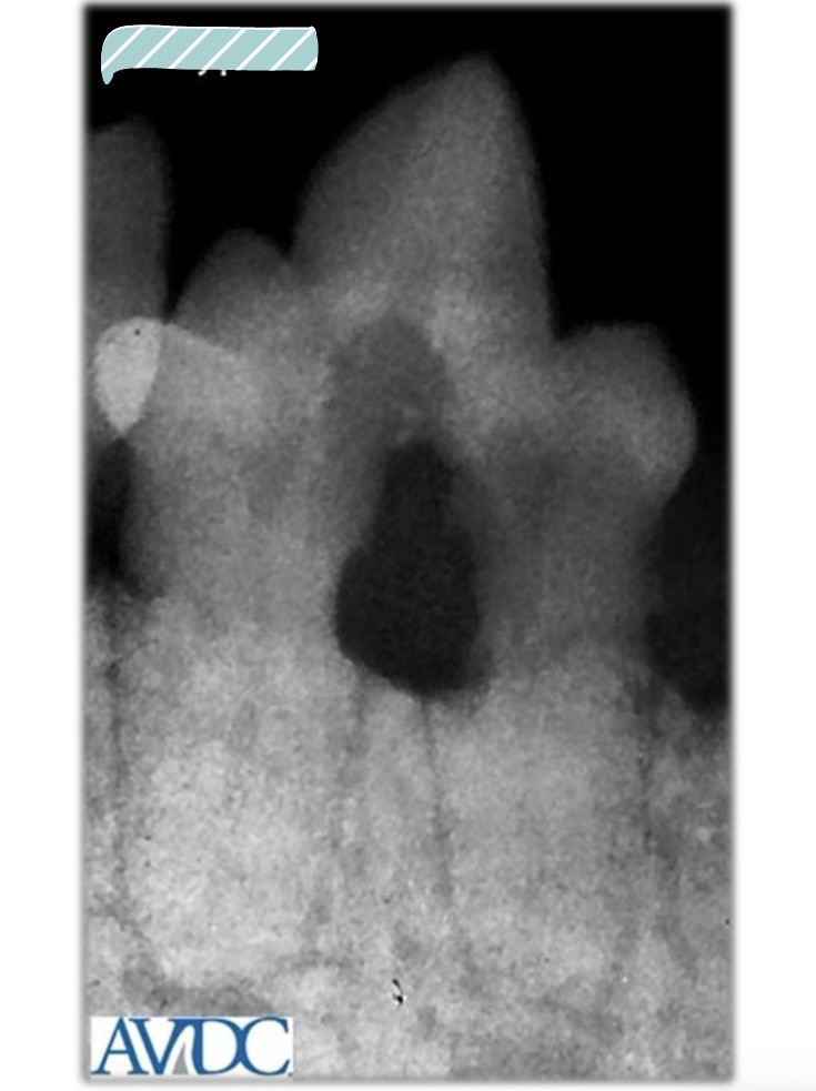<p>what type of tooth resorption is this?</p>