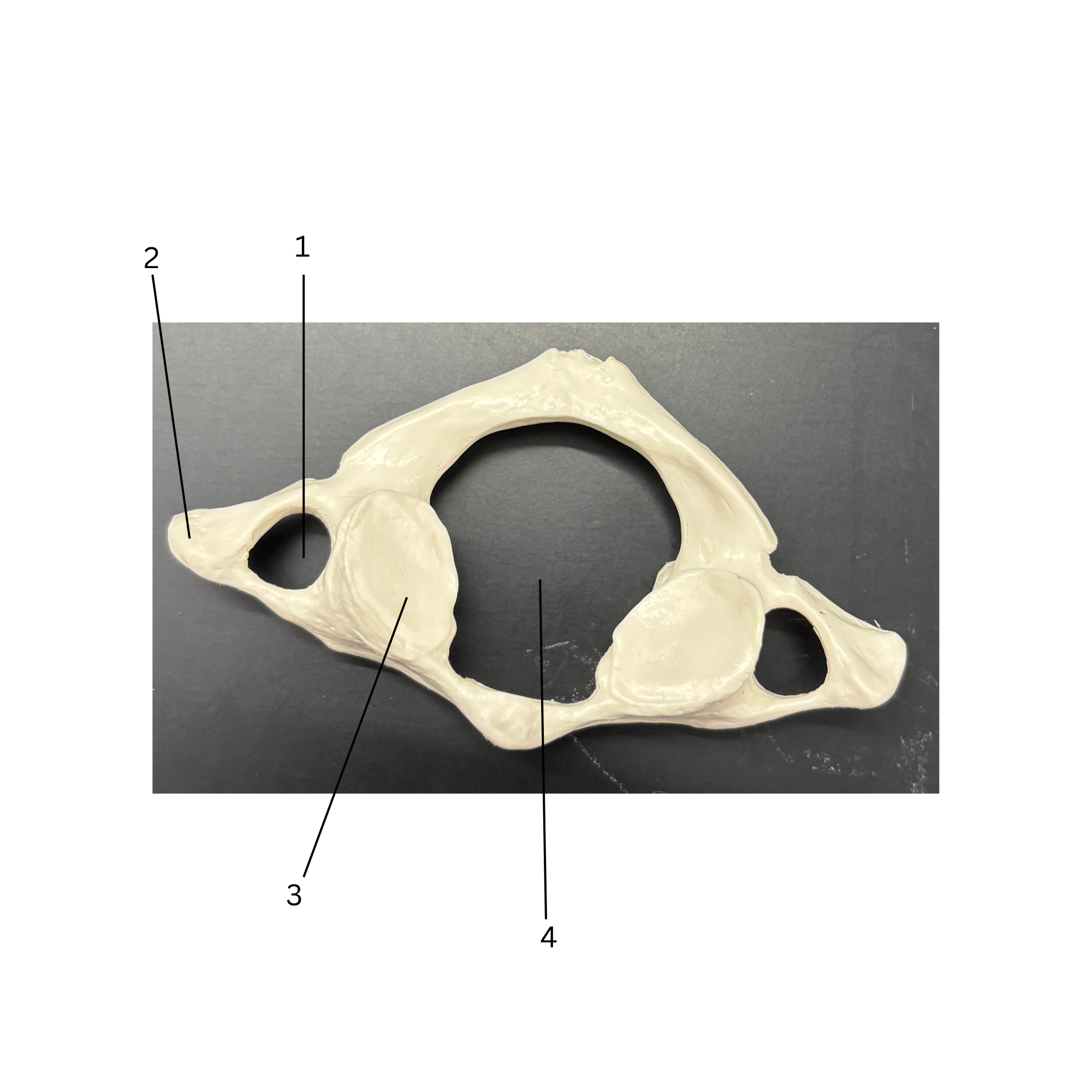 <p>What bone is this</p>