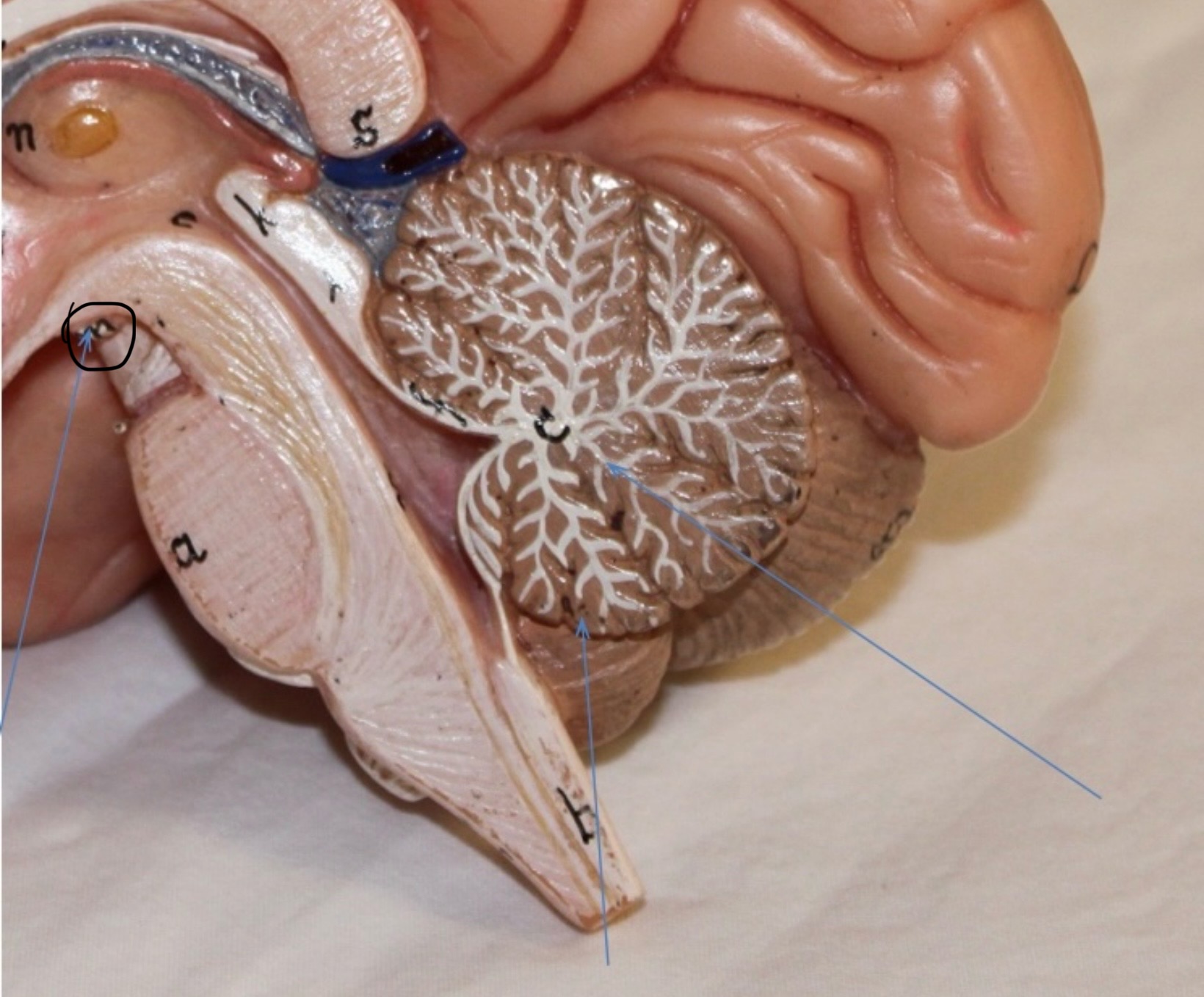 <p>Identify the circled area?</p>