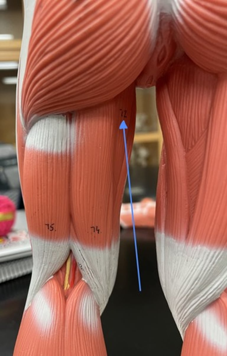 <p>adductor magnus 72</p><p>origin:</p><p>insertion:</p><p>action:</p>