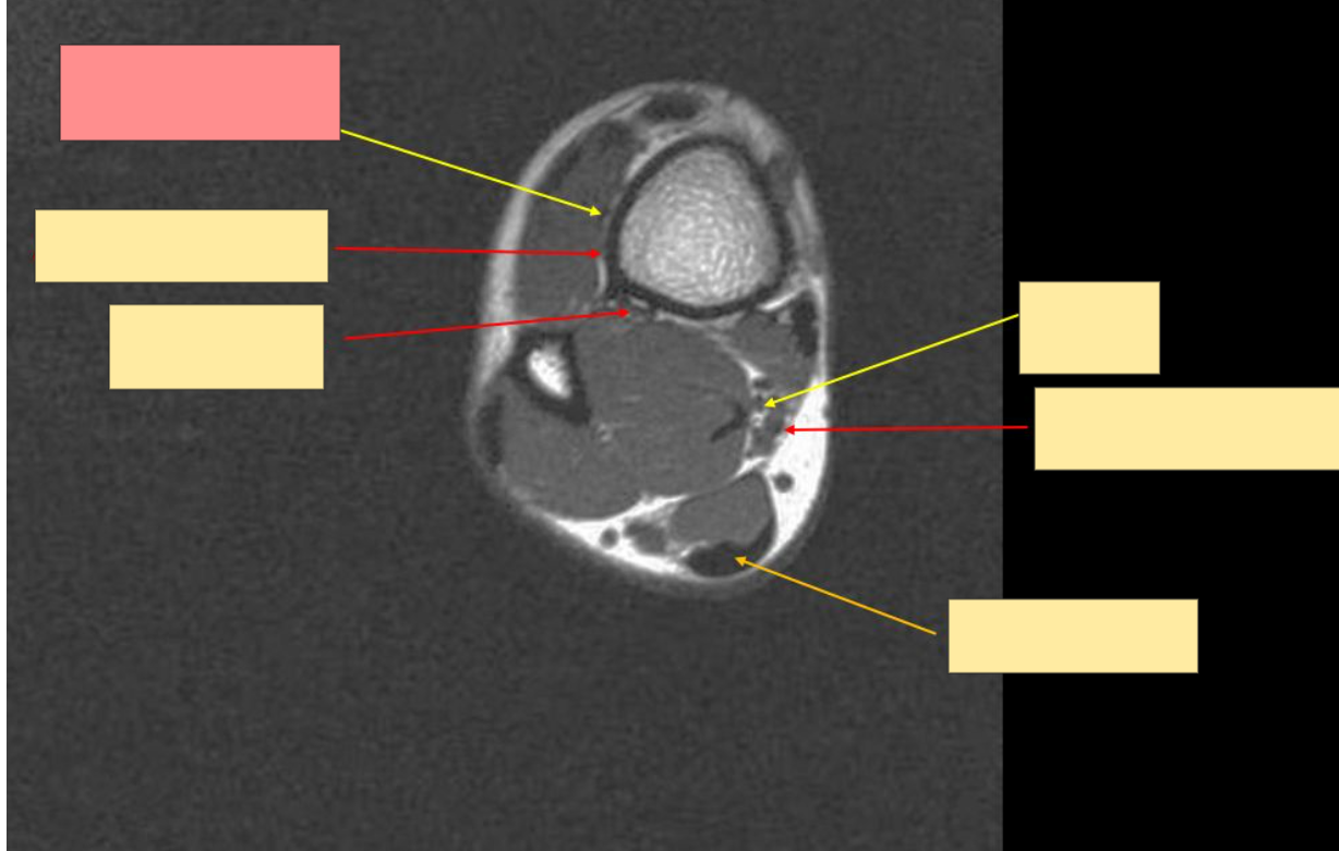 <p>Identify the structure</p>