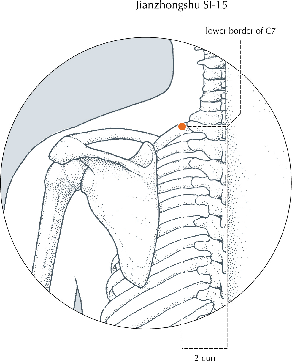<p>Oblique medial insertion towards the spine 0.5 to 1 cun.<br>Caution: deep insertion inferiorly, especially in thin patients, carries a substantial risk of inducing a<mark data-color="yellow" style="background-color: yellow; color: inherit;"> pneumothorax.</mark></p><p></p><p></p>