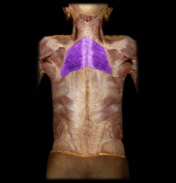 <p>What is this superficial muscle (highlighted)?</p>