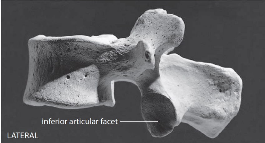 <p>Inferior Articular Facets</p>