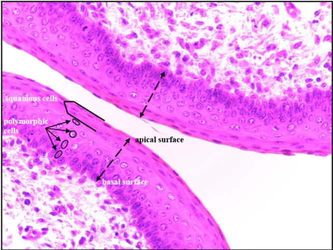<p>Stratified Squamous epithelium</p>