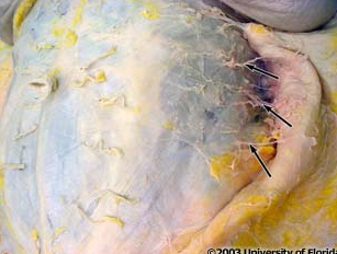 <p>what vessels are indicated in the image; these vessels pierce the external abdominal oblique muscle and overlying deep investing fascia along the midaxillary line and pass anteriorly in the plane of superficial fascia</p>