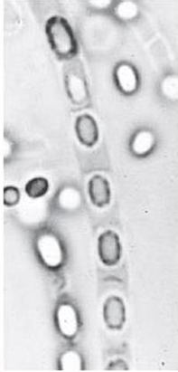<p>identify;</p><ul><li><p>spore location</p></li><li><p>bacteria</p></li></ul><p></p>