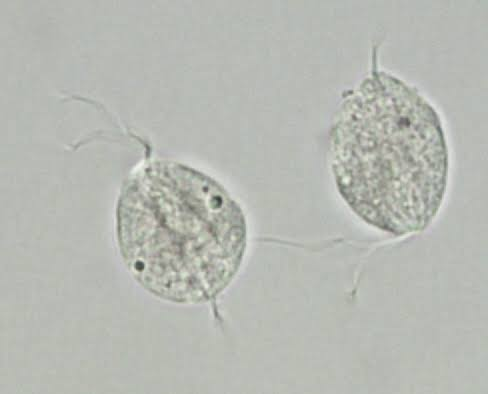 <p>Common cause of vaginitis due to flagellated protozoan (T. Vaginalis) </p><p>-Presentation: green/yellow malodorous vaginal discharge, burning, pruritus, dysuria, postcoital bleeding, erythematous vaginal mucosa, and strawberry cervix on exam </p><p>-Dx: wet prep shows mobile flagellated organisms and many leukocytes </p><p>-Tx: Metronidazole </p>