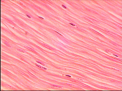 <p>- Involuntary muscle found inside many internal organs of the body</p>