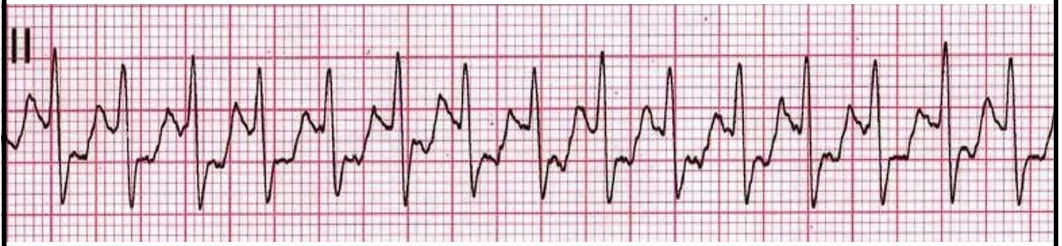<p>Name this rhythm </p>