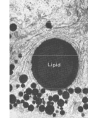<p>Bevatten bijna uitsluitend triacylglycerolen en dienen als energiereserve of als reserve van lipideprecursoren. Op E.M.-foto's herkenbaar aan homogene, ronde vorm. Worden gevormd door het S.E.R. In adipocyten (vetcellen) kan de gehele cel uit één grote vetdruppel bestaan. Vetzuren uit vetdruppels worden afgebroken via β-oxidatie in de mitochondriën — op E.M.-foto's ziet men dan ook vaak een duidelijke associatie tussen vetdruppels en mitochondriën.</p>