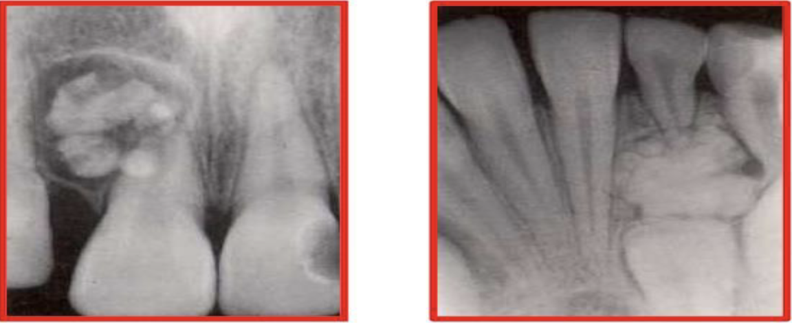 term image