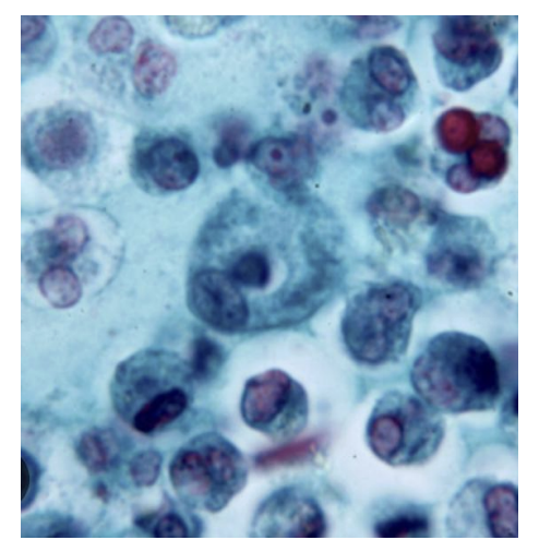 <p>seen in stool microscopic examination</p>