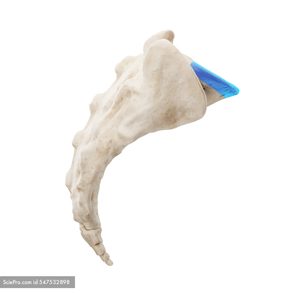 <p>anteriorly projecting ridge on the superior aspect of the sacrum</p>