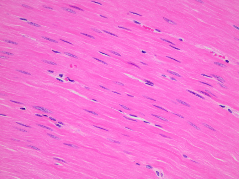 <p>involuntary muscles</p>